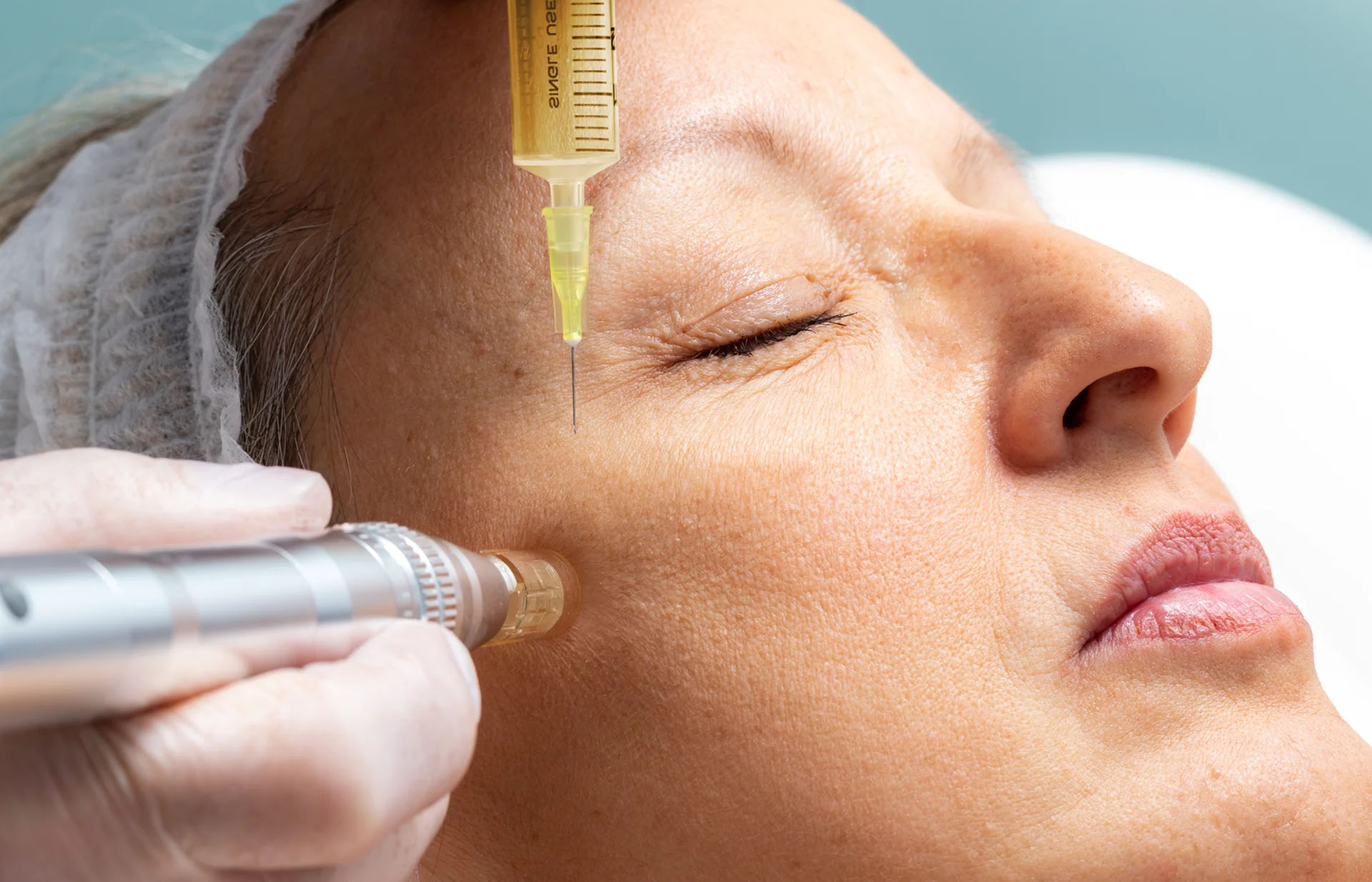 Micro Needling & Face PRP